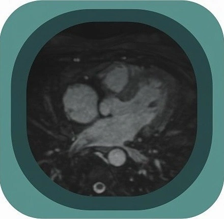 mri heart and coronary anatomy icon